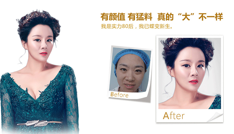 开封脂肪移植、隆鼻