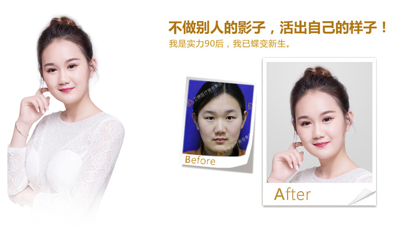 开封纳米脂肪移植