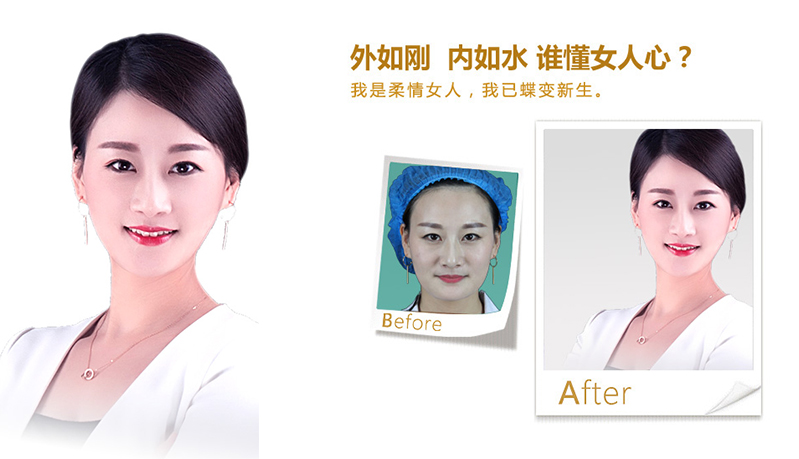 开封V脸、线雕隆鼻